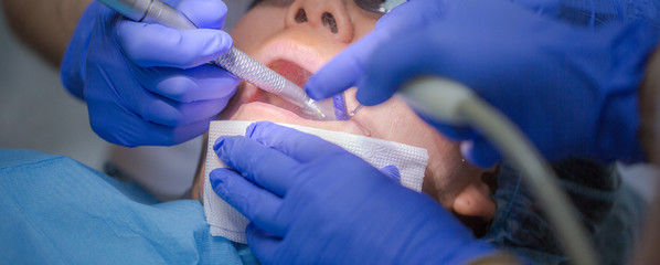Asian female patient on dentist appointment during dental procedure. Human mouth open close up....