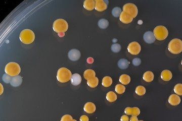 Close up of colourful bacterial colonies in Petri dish. Medical abstract background. Medical laboratory, medical glassware concept...