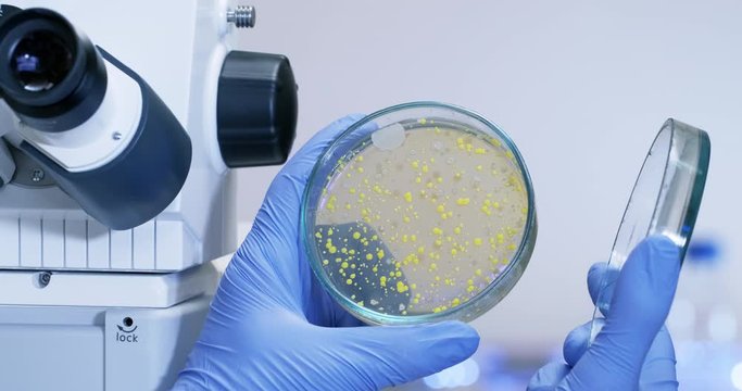 Bacteria analysis on a Petri dish, the scientist opens a Petri dish next to the microscope and examines the bacterial colonies, isolation of beneficial bacteria.