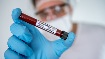 Man with test tube of infected blood sample for COVID-19. Positive coronavirus