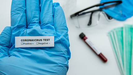 Scientist hold identifier sticker for test tube infected blood sample COVID-19