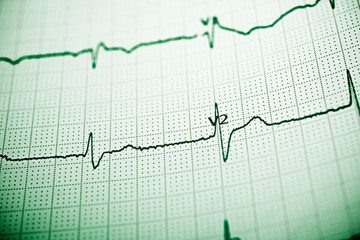 Electrocardiograph close up