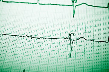 Naklejka premium Electrocardiograph close up