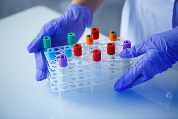 A medical professional, laboratory assistant, doctor performs an analysis in a laboratory, uses...