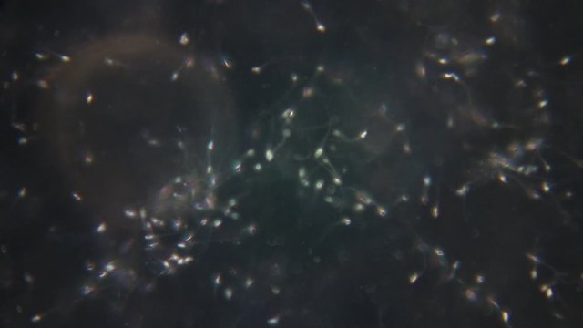 Semen, seminal fluid of Human under the microscope.