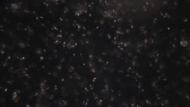 Semen, seminal fluid of Human under the microscope.