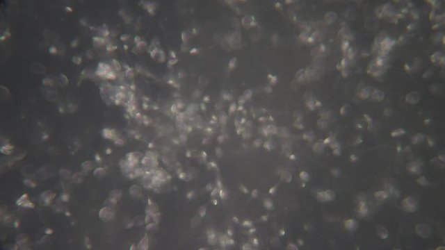 Semen, seminal fluid of Human under the microscope.
