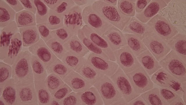 Root tip of Onion and Mitosis cell in the Root tip of Onion under a microscope.