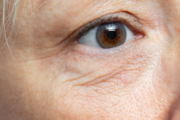 Obraz premium Macro detail of under eye wrinkles on middle aged woman.