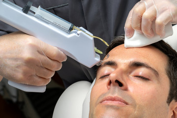 Micro needling technology used on middle aged man