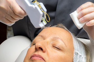 Middle aged woman having micro needle  mesotherapy on forehead.