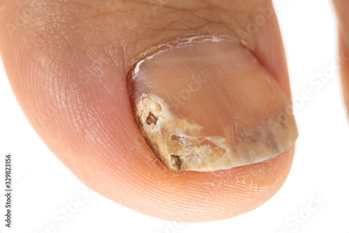 爪水虫 Wall Mural Wallpaper Murals Wallsheaven Caito