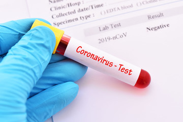 Test tube with blood sample for coronavirus test