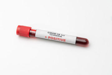 COVID 19 Coronavirus, infected blood sample in the sample tube