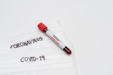 COVID 19 Coronavirus, infected blood sample in the sample tube