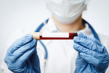 Doctor holding blood test tube