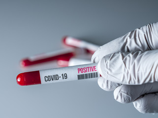 Obraz premium Medical glove holding a tube of blood with a positive result for test for Covid-19 or coronavirus