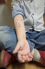Fototapeta premium Little boy shows his arm after nurse encircled the allergy positive dots