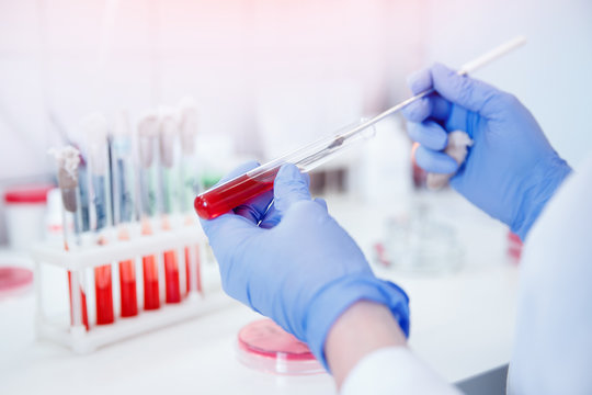 Nurse Microbiologist Holding Test Tube With Blood For Coronavirus 2019-nCoV Analyzing