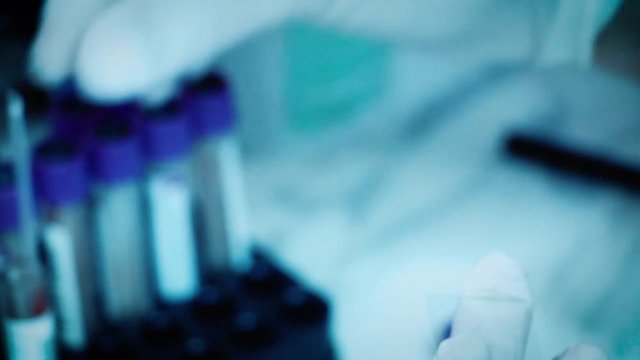 Muestra de sangre en laboratorio