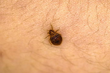 Bed Bug On Skin 