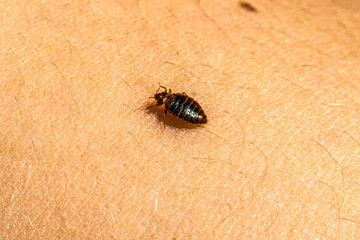 Bed Bug On Skin 