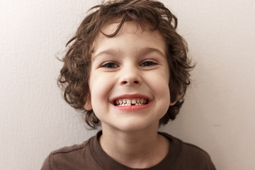 Charming curly boy smiles without tooth on white background. The boy lost the first milk tooth....