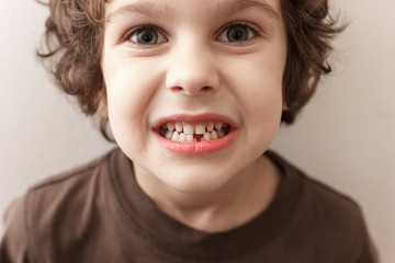 Charming curly boy smiles without tooth on white background. The boy lost the first milk tooth. Healthy teeth concept, dental clinic.