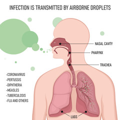 Obraz premium Infection is transmitted by airborne droplets. Human body with lungs affected by virus cells through the respiratory tract.
