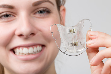 young female teenager shows her removable dental brace