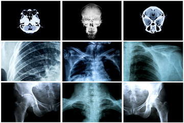 Collage of many X-rays. Very good quality , Many others X-ray 