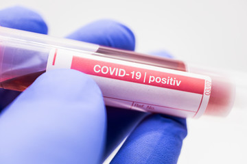 Covid-19 Bluttest