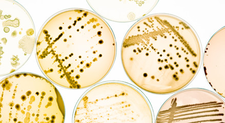 Mixed of bacteria colonies and fungus in various petri dish