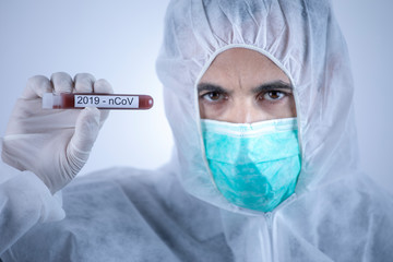 medico con tuta protettiva e mascherina tiene in mano una provetta per il test del sangue del...