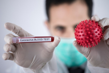 Provetta con sangue per esame sul coronavirus