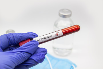 Fototapeta premium Coronavirus blood test 2019.Coronavirus came from Wuhan, China. Doctor hand in medical glove holding test tube with Coronavirus positive blood in laboratory. Concept can be used in the design