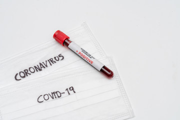 COVID 19 Coronavirus, infected blood sample in the sample tube