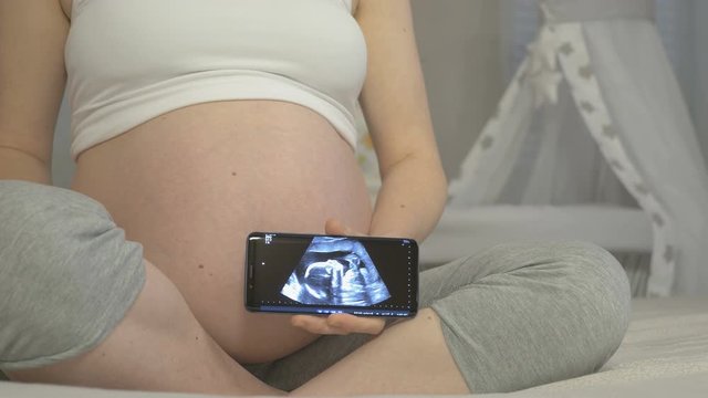 A pregnant woman is holding a smartphone with an ultrasound examination of her unborn baby screen. The nine months of pregnancy, conceptual footage