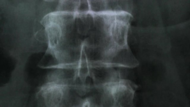 X-ray of the bones of the human vertebral column and pelvis, 4K