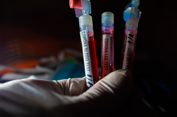 Professional doctor or lab technician holding blood sample with novel (new) coronavirus N.C.P....