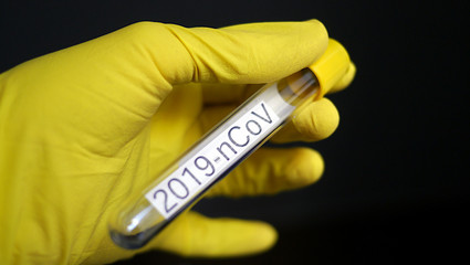 Probówka z próbką koronawirusa nCoV-19, powodującego chorobę COVID-19, wirus SARS, badanie wirusa w laboratorium, szukanie szczepionki na śmiertelnego wirusa powodującego epidemię, pandemię na świecie
