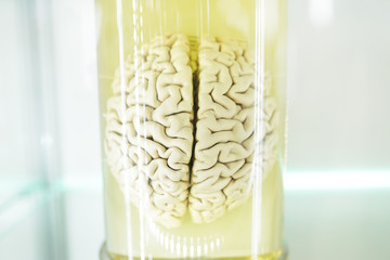 Human brain in a jar (real specimen)