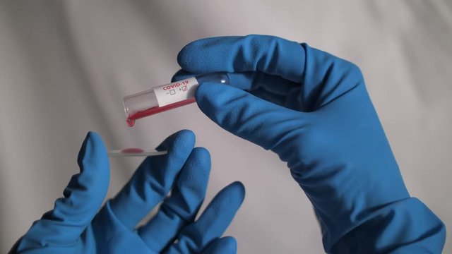 Medical doctor or laborant drop blood from tube with infected blood for 2019-nCoV COVID virus investigating. Novel Coronavirus originating in Wuhan, China. Coronavirus 2019-nCoV COVID concept