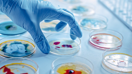 Scientist Works with Petri Dishes with Various Bacteria, Tissue and Blood Samples. Concept of...