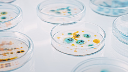Microbiology Laboratory: Petri Dishes with Various Bacteria Samples, Pipette Drops Liquid Solution. Concept of Pharmaceutical Research of Antibiotics, Curing Disease Fighting Epidemics. Close-up Macro