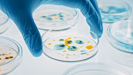 Scientist Works with Petri Dishes with Various Bacteria, Tissue and Blood Samples. Concept of...