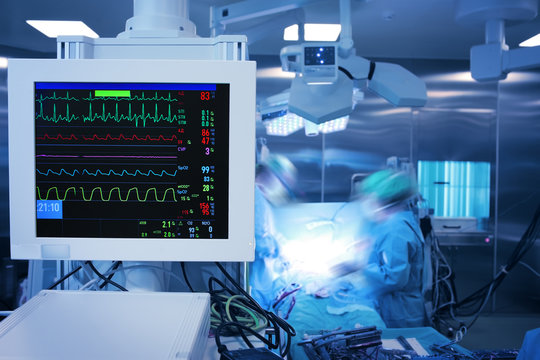 Heart monitor with multi-colored heartbeat lines against the group of working surgeons in the operating theatre