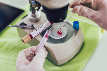 Doctor in the laboratory with a biological tube for analysis and sampling of Covid-19 infectious disea.
