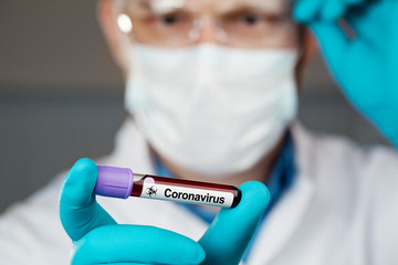 Coronavirus 2019-nCoV Blood Sample.