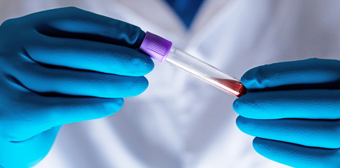 Coronavirus 2019-nCoV Blood Sample.